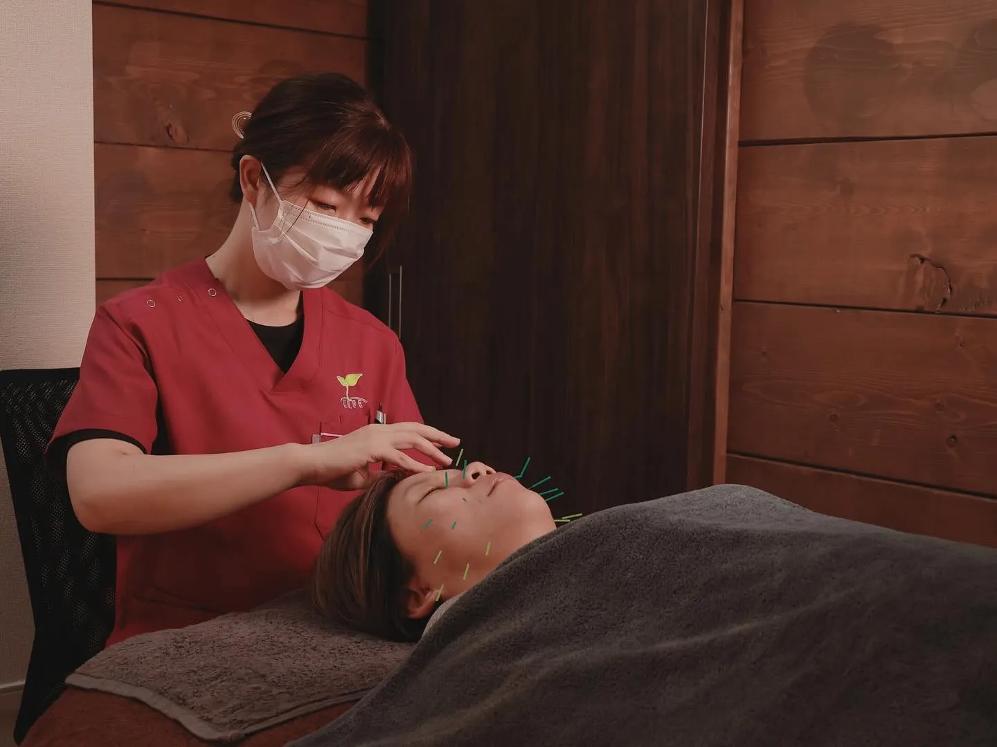 美容鍼は男女共に人気です✨